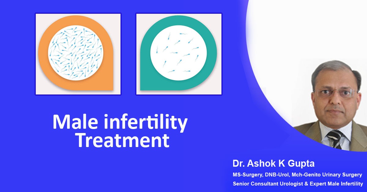 Male Infertility Treatment
